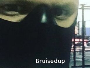 Bruisedup