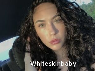 Whiteskinbaby