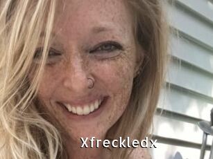 Xfreckledx
